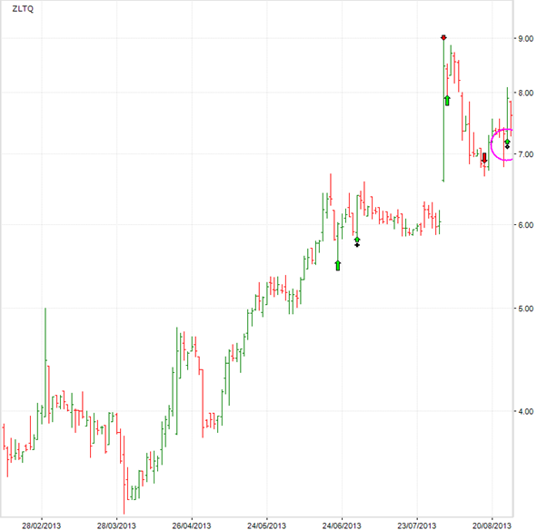 Zeltiq Stock Chart